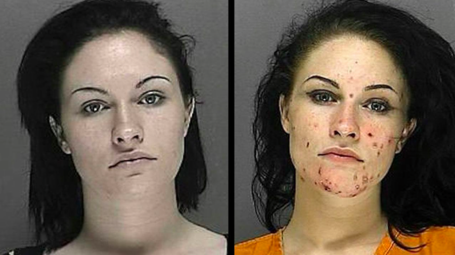 Pictures of crack cocaine users
